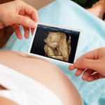 Вопросы и ответы при УЗИ при беременности